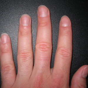 Co robić ze skórkami?