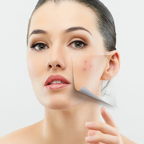 W jaki sposób zapobiegać przetłuszczaniu się skóry?