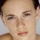 Jak pozbyć się przebarwień po pryszczach?