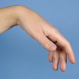 Przyczyny problemów z nadgarstkiem