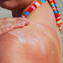 Sposoby leczenia uczulenia na słońce