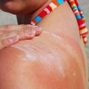 Sposoby leczenia uczulenia na słońce