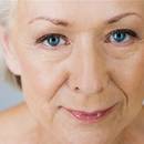 Długa młodość – sposoby na zmarszczki na twarzy