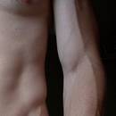 Jak objawia się zapalenie naczyń krwionośnych?