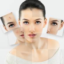 W jaki sposób tuszować niedoskonałości cery?