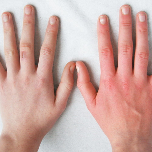 W jaki sposób pielęgnować dłonie i paznokcie?