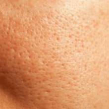 Sposoby zmniejszania porów na twarzy