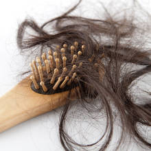 Jakie są przyczyny wypadania włosów?