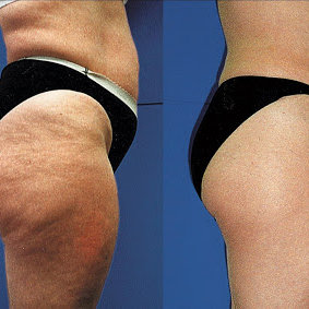 Moc kawy i kokosowego olejku