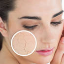 Naturalne sposoby na suchą skórę