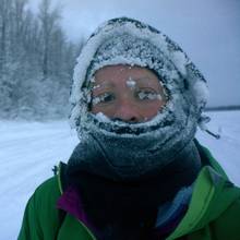 Jak wygląda pierwsza pomoc przy odmrożeniach?