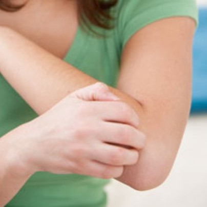 Jak domowymi sposobami wyleczyć atopowe zapalenie skóry?