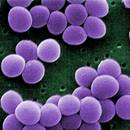 Jak postępować w razie zakażenia gronkowcem?