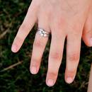 Jakie są przyczyny czerwonych dłoni?