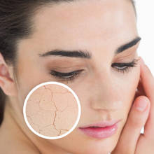 Jakie kosmetyki wybierać dla cery suchej i wrażliwej?