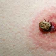 Niebezpieczne kleszcze