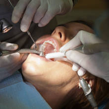 Jak przetrwać wyrwanie zęba mądrości?