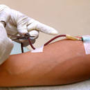 Oddawanie krwi – wskazówki i rady