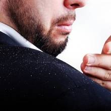 Jak walczyć z łupieżem domowymi sposobami?