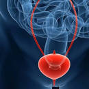 Po czym poznać zapalenie pęcherza?