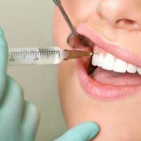 Usunięcie zęba – zalecenia i rady