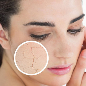 Przesuszenie skóry, owłosienie ciała