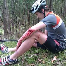 Jak sobie radzić z kontuzjami na wakacjach?