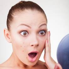 Jak zapobiegać niedoskonałościom na twarzy?