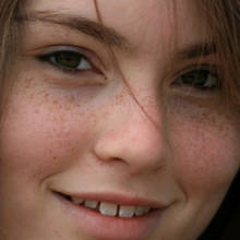 Usuwanie piegów – wskazówki i porady