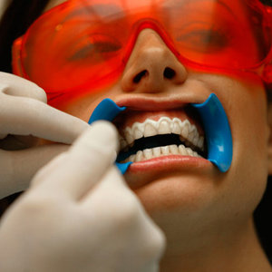 Czemu pojawia się próchnica?