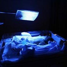 Jak leczyć depresję zimową?