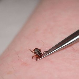 Nie wykręcaj kleszcza