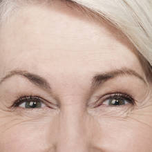 Jak pozbyć się zmarszczek mimicznych?