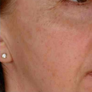 Ostrożnie z temperaturą