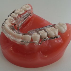 Inman Aligner