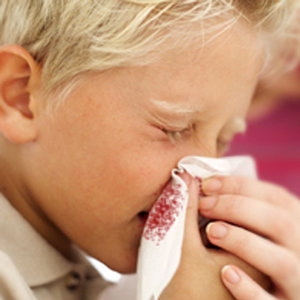 Pozbycie się skrzepów