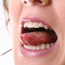 Co może oznaczać nalot na języku?