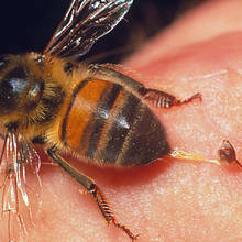 Jak sobie poradzić z wyjęciem żądła pszczoły?