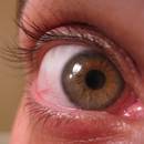 Dobre sposoby na suche oczy