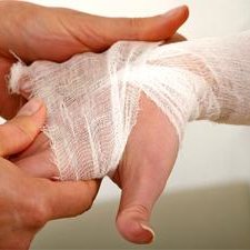 Pierwsza pomoc przy oparzeniach chemicznych – krok 2