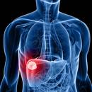 W jaki sposób zregenerować wątrobę?