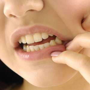 Przyczyny powstania zajadów