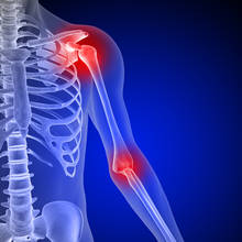 W jaki sposób zapobiegać bólom stawów?