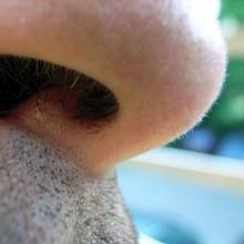 Sposoby na usunięcie włosów z nosa