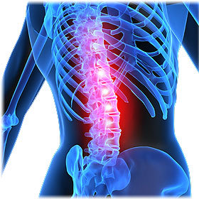 Co powoduje bóle kręgosłupa?