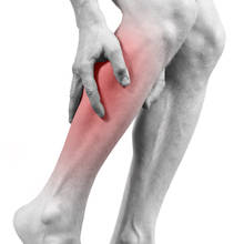 Naturalne metody leczenia żylaków