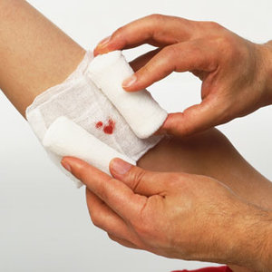 Jak zatamować krew i założyć opatrunek?