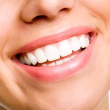 Jak uniknąć paradontozy?