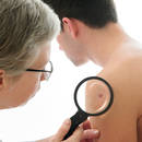 Naturalne sposoby na wysypkę