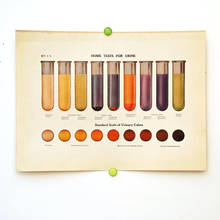 Jakie znaczenie ma kolor moczu?